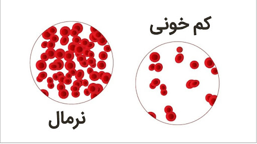 نمای کم خونی